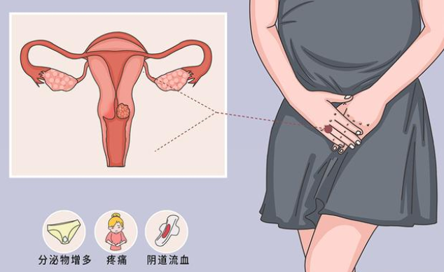 女性如何做好私处护理