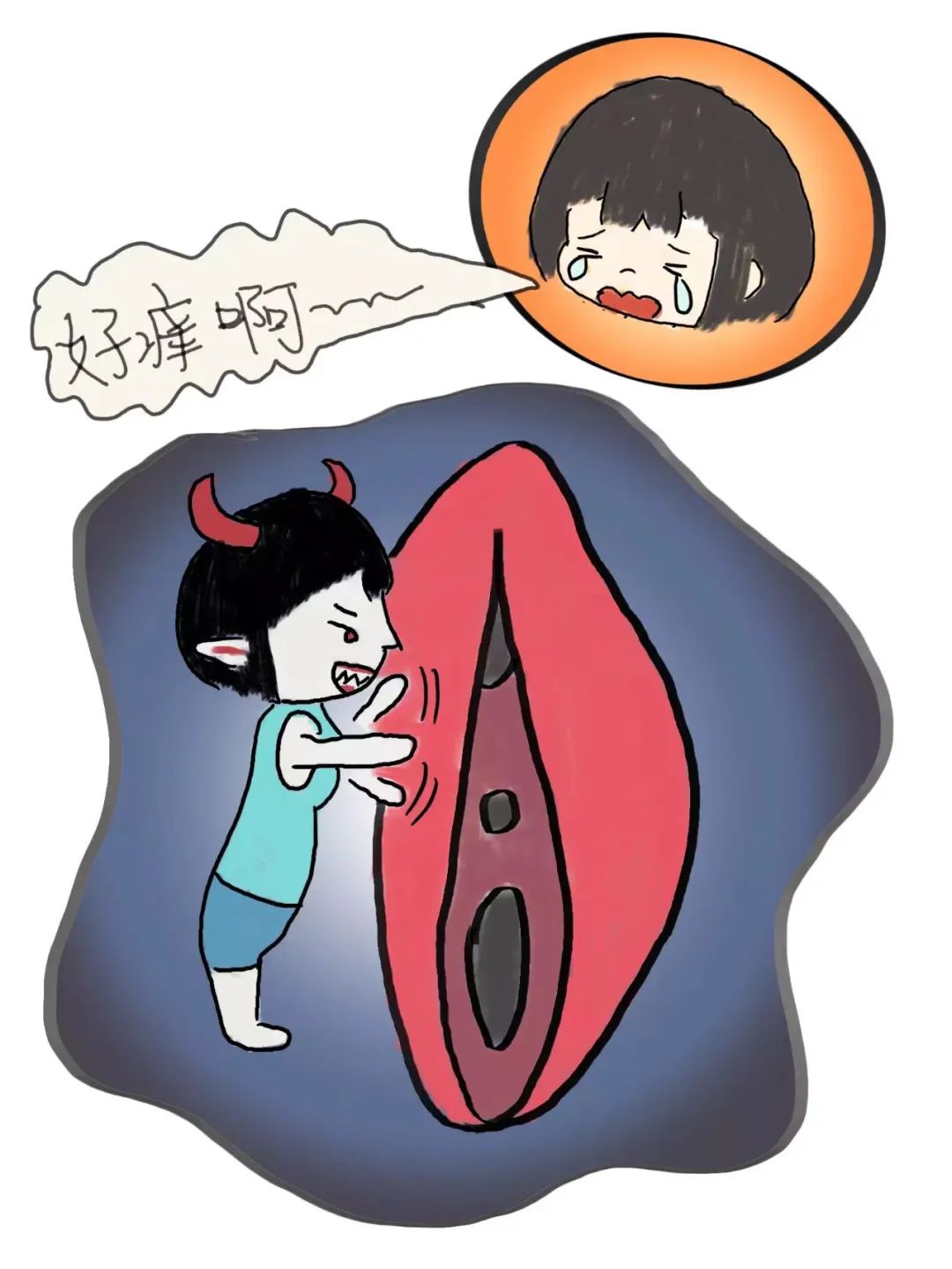 外阴白斑能彻底根治好吗?
