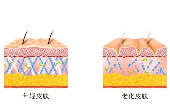 外阴白斑患者为什么还要戒糖？