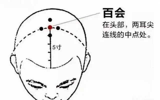 得了外阴白斑冬天吃什么才比较养生？