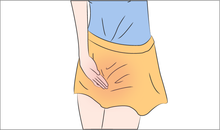 外阴白斑疾病为什么会使女性外阴产生裂口？