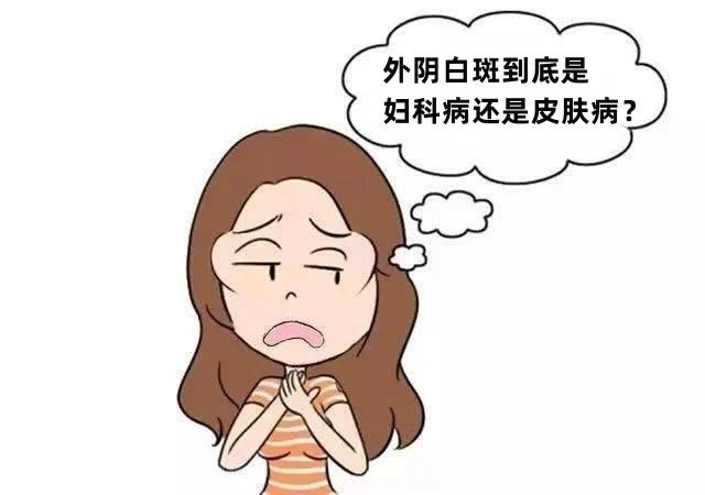 得了外阴白斑应该挂什么科? 得了外阴白斑应该挂什么科?
