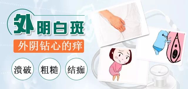 外阴白斑疾病加重都会有哪些不容忽视的表现? 外阴白斑疾病加重都会有哪些不容忽视的表现?