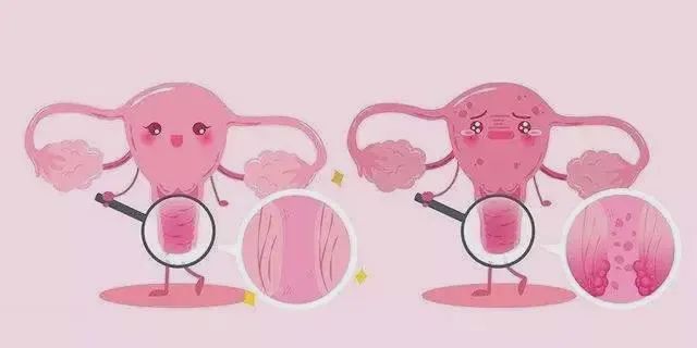 女性朋友患上外阴白斑后该怎么办? 女性朋友患上外阴白斑后该怎么办?