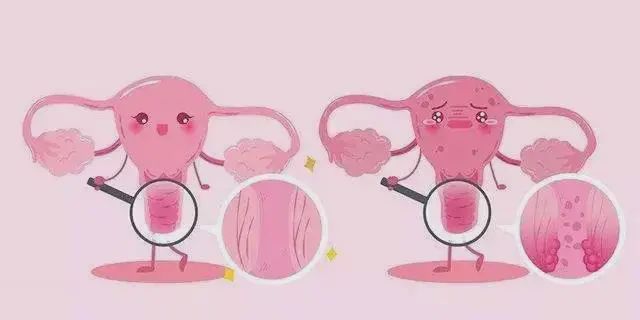 外阴炎和外阴白斑早期的区别? 外阴炎和外阴白斑早期的区别?