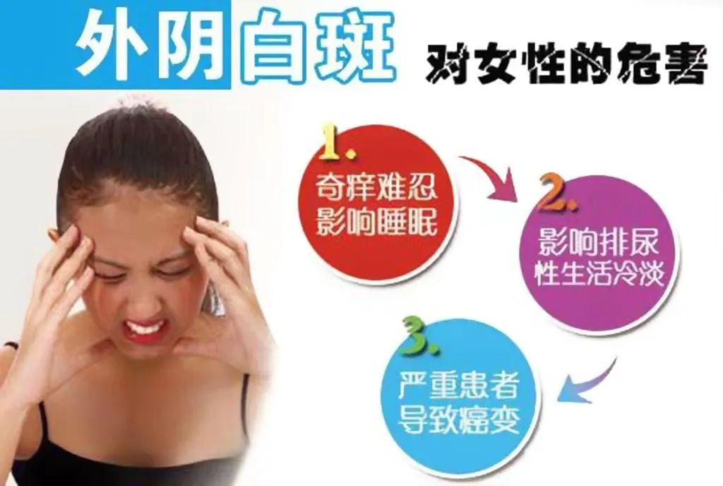 怎么防止外阴白斑扩散? 怎么防止外阴白斑扩散?