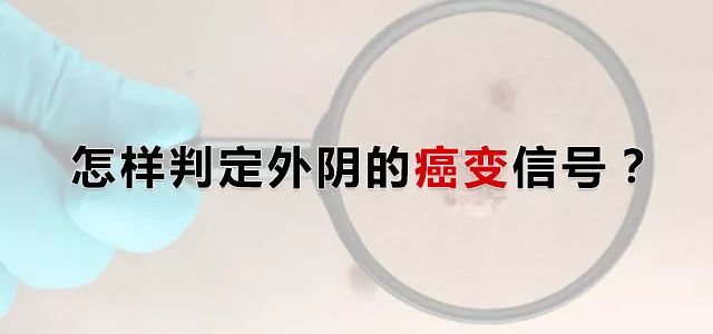 外阴白斑演变为外阴癌变都有哪几个信号? 外阴白斑演变为外阴癌变都有哪几个信号?